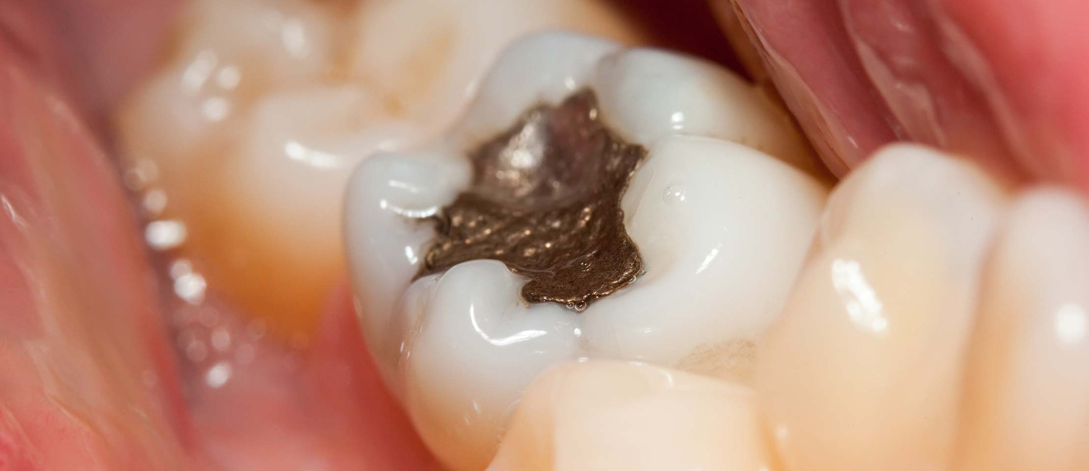 biological dentistry