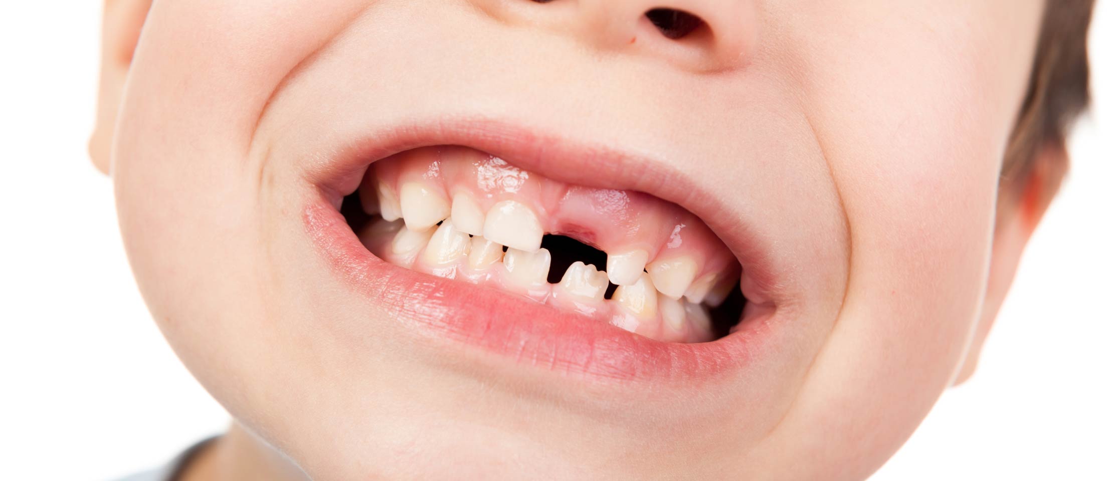 dentisterie pédiatrique